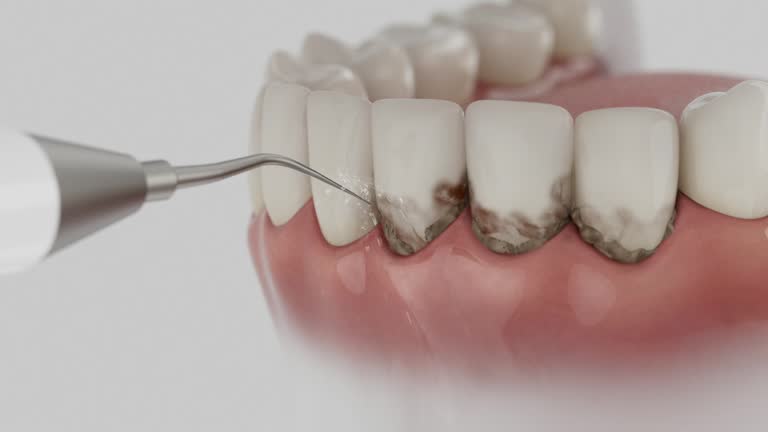 Reliable Dental Implants contractor in Central, LA by Smile Center Dentistry